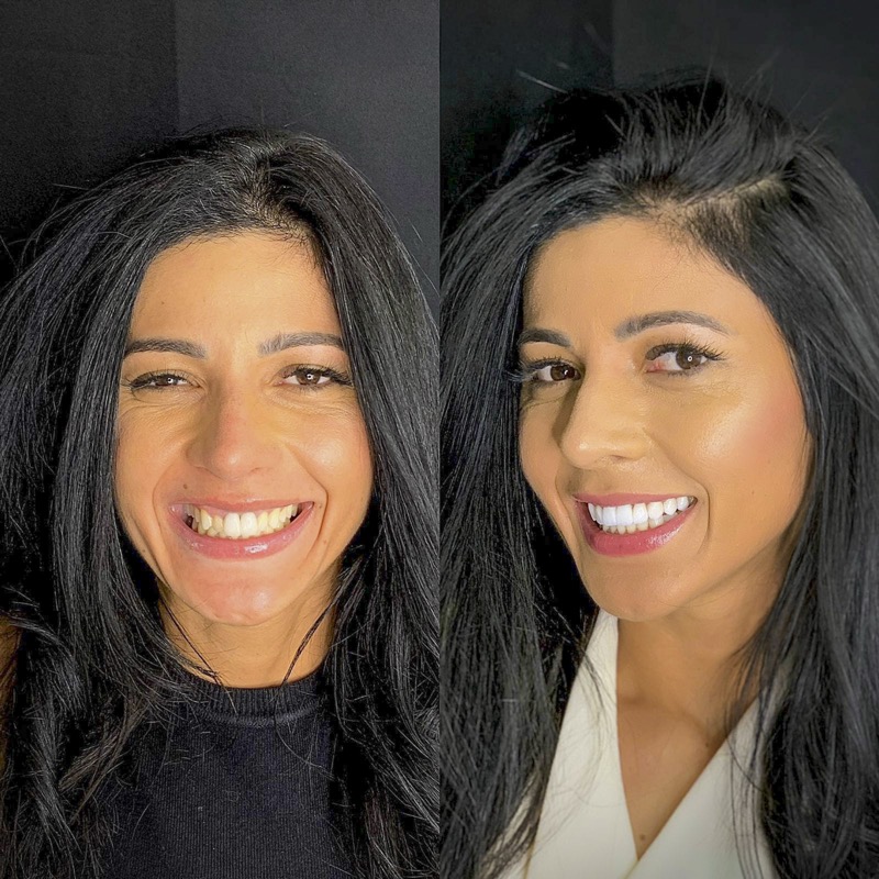 Juliana, paciente da Studio Orofacial